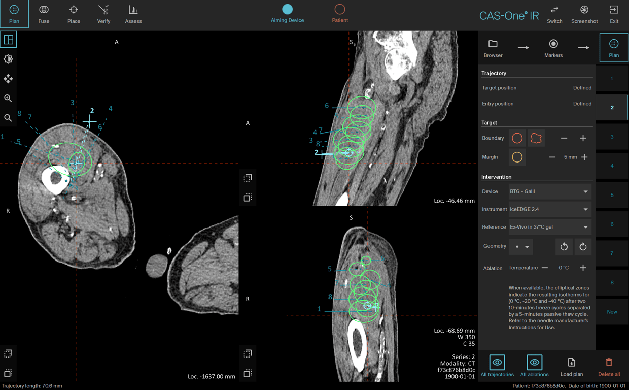 01_Planning_MPR_Cryo_Bern