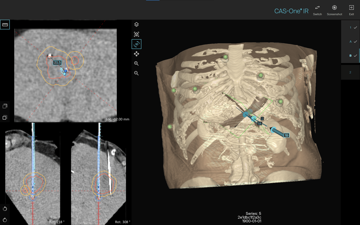 02_Needle2_3dFreiburg_case