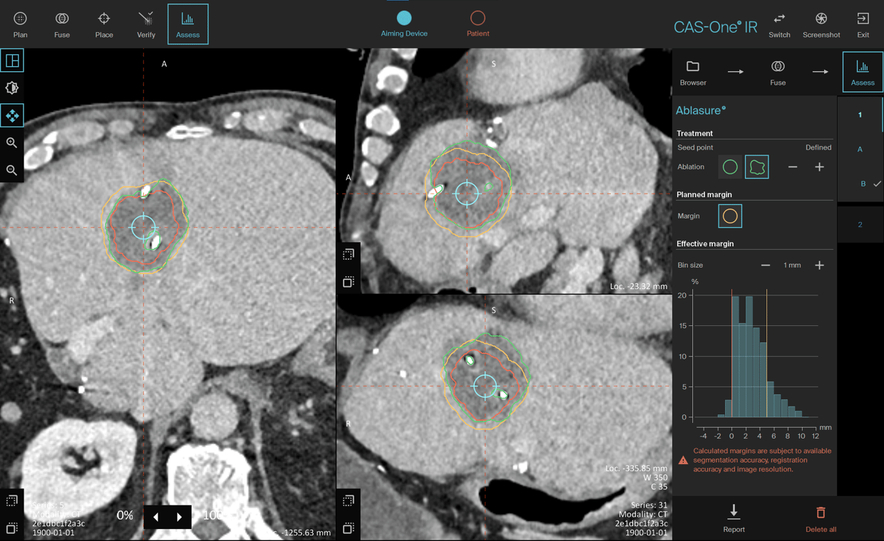 03_Assess_2022-01-21 142753_freiburg_case