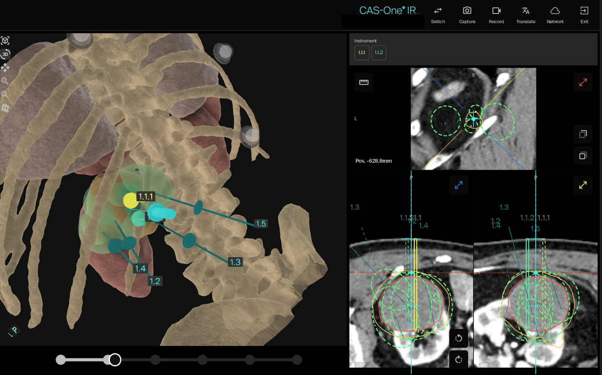3D Recon Kidney 1