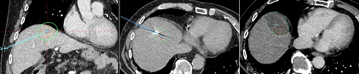 Basingstoke Case Overview new