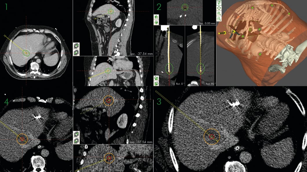 Case_Basel_September_2019_Overview