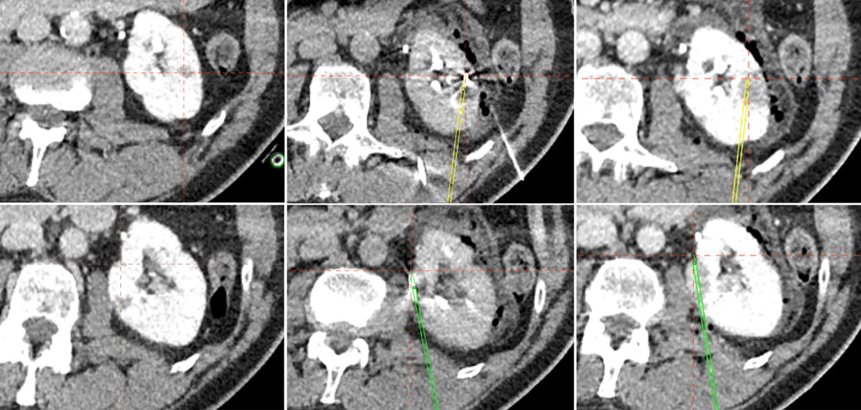 Case_Bern_Cryo_Overview