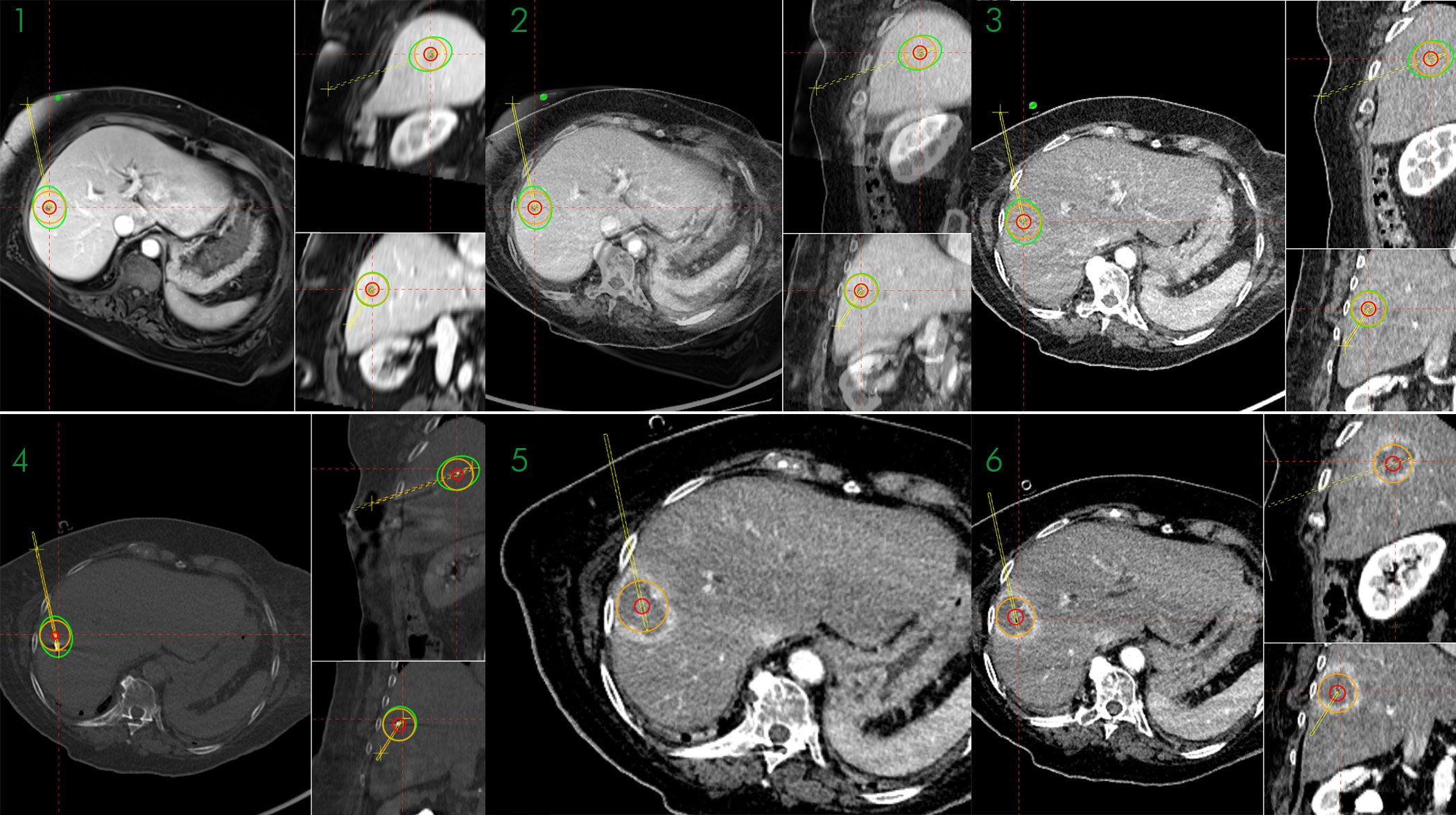 Case_Overview_June_2019