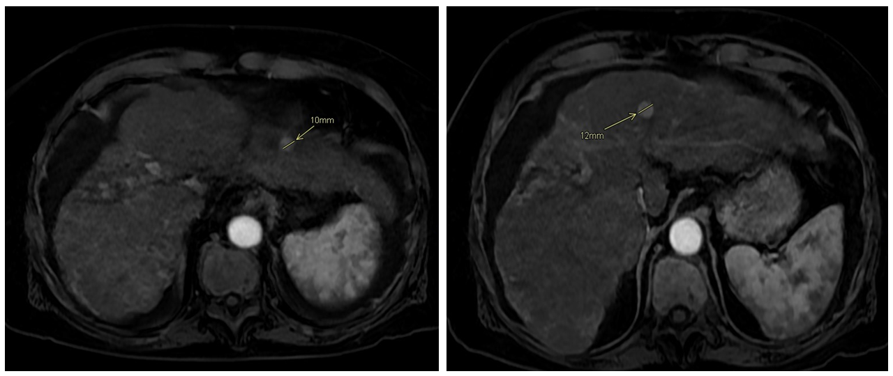MRI Madrid