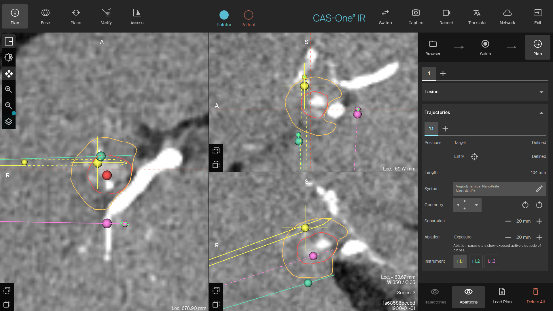 Planning scan