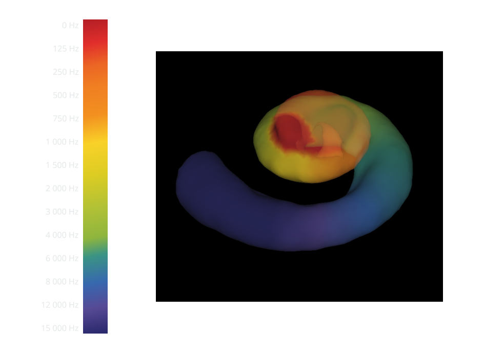 audiogram with scale