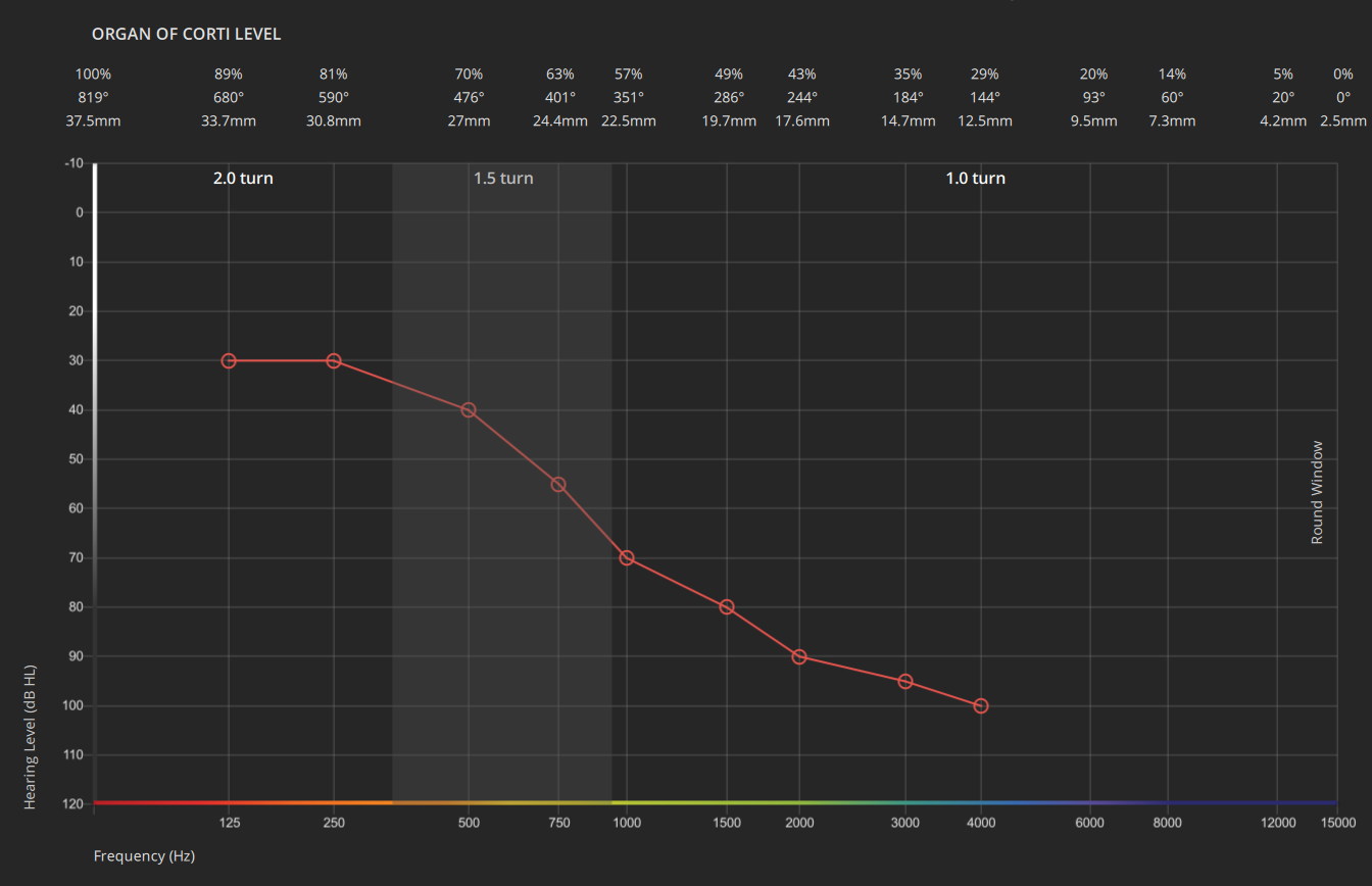 audiogram audiogram