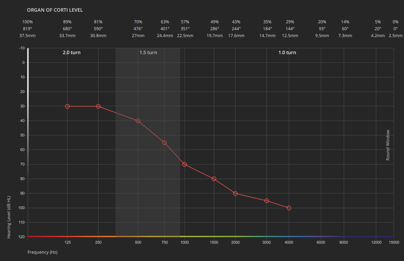 audiogram