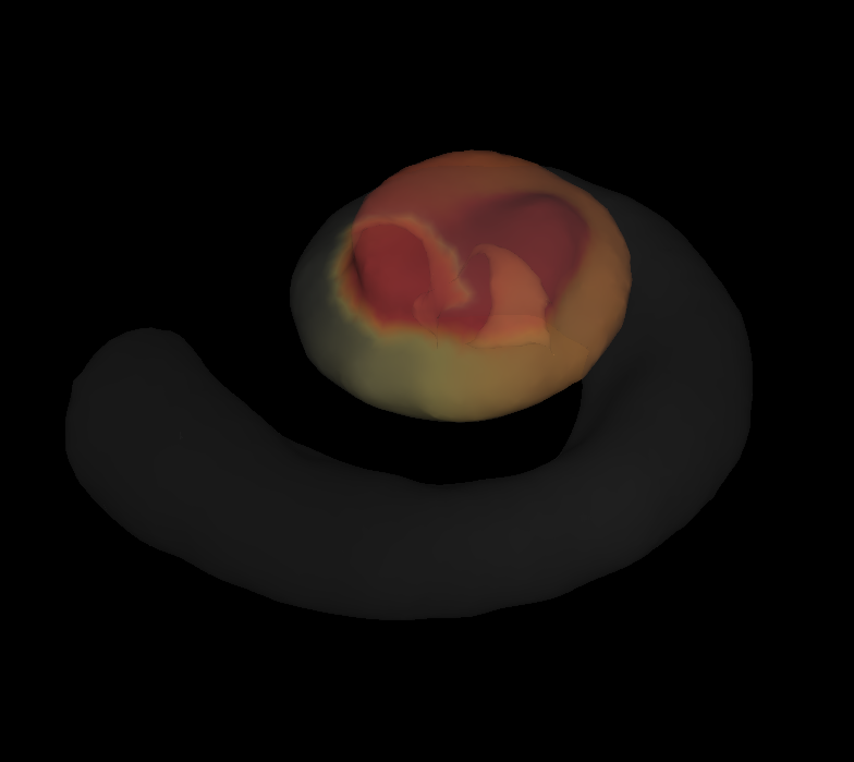 cochlea1 cochlea1