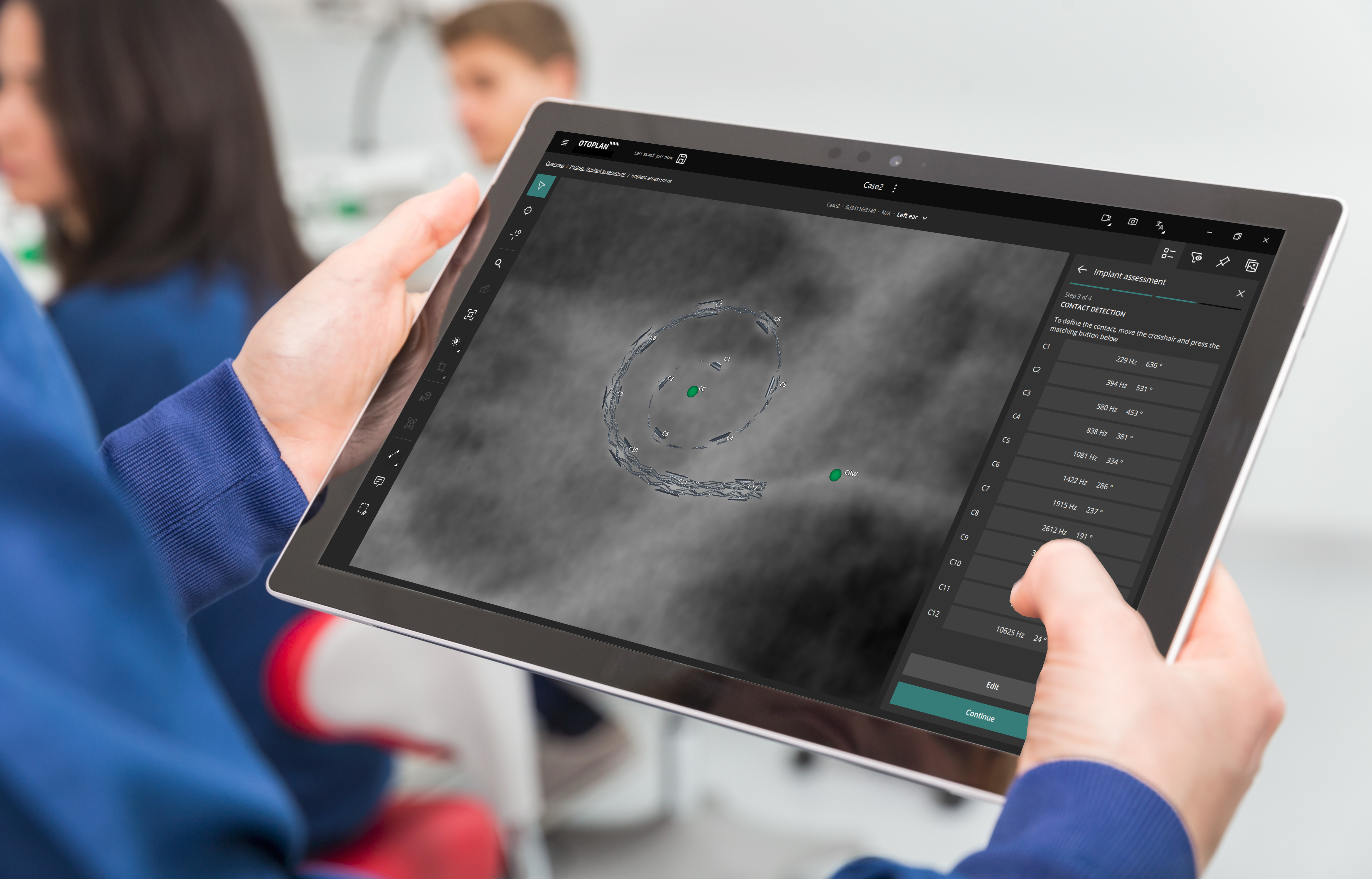 Make Anatomy-Based Fitting possible for your patients