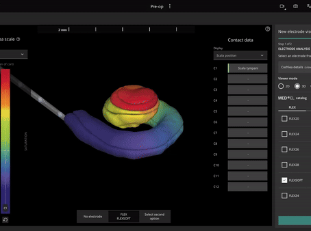 Preoperatively-visualize-the-electrode--in-your-patient’s-cochlea-model